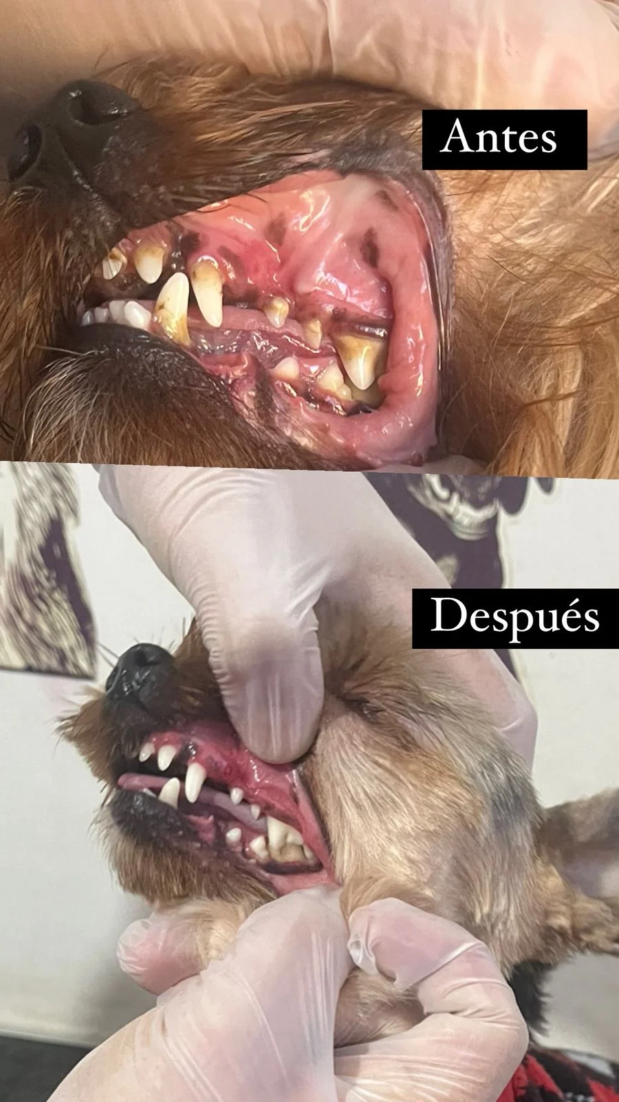 Antes y después dental 1