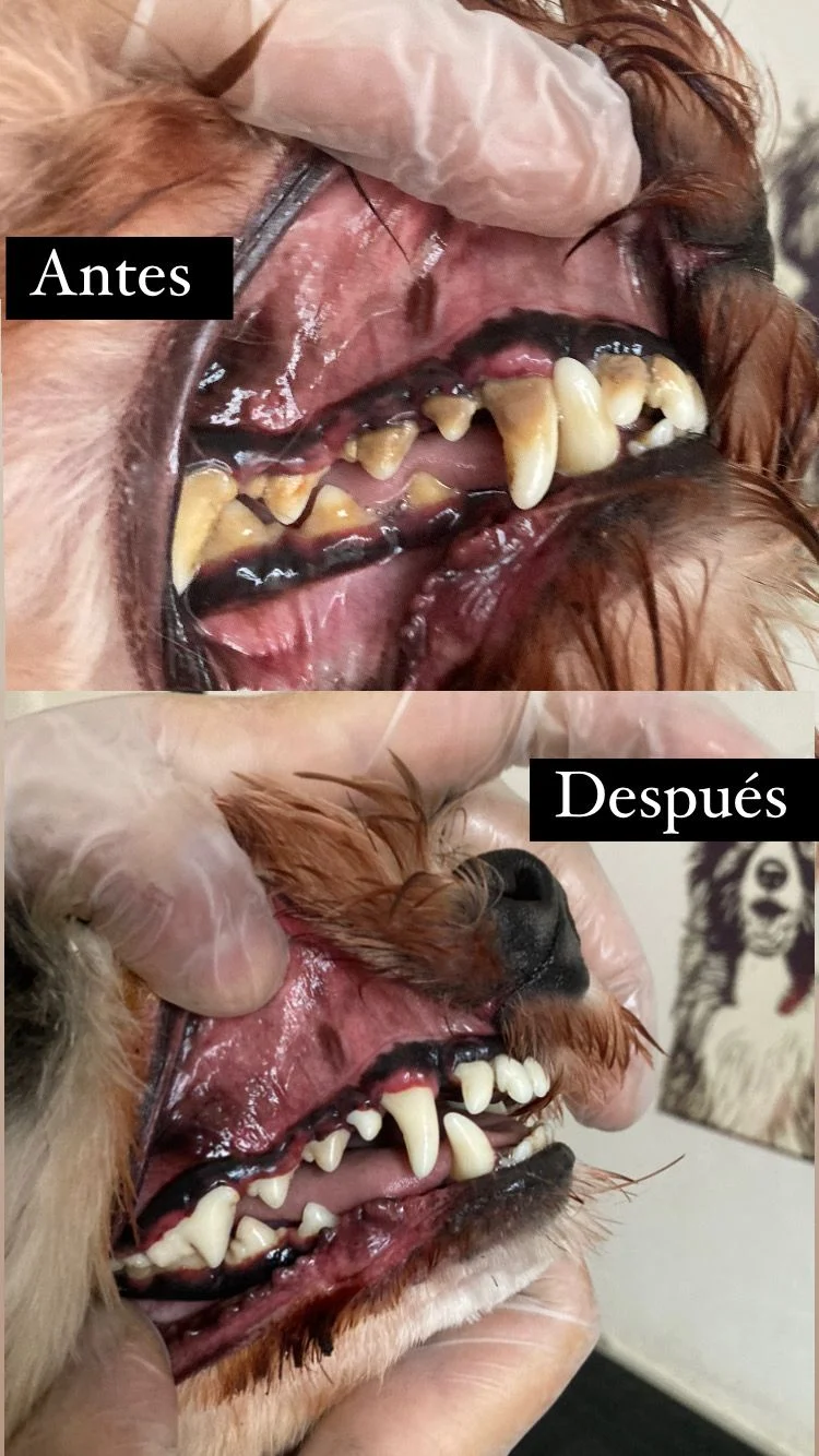 Antes y después dental 3
