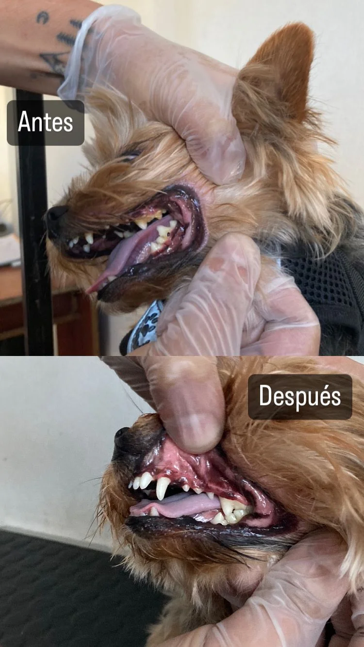 Antes y después dental 4