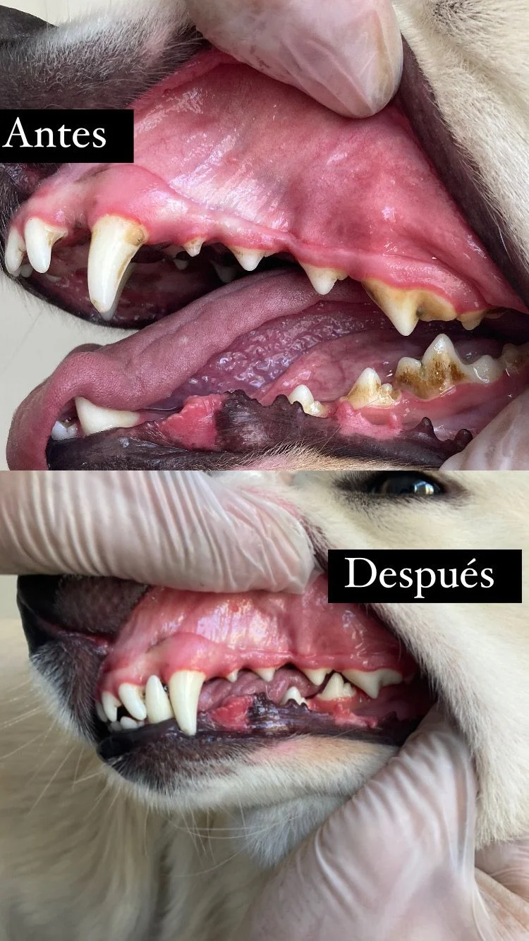 Antes y después dental 5