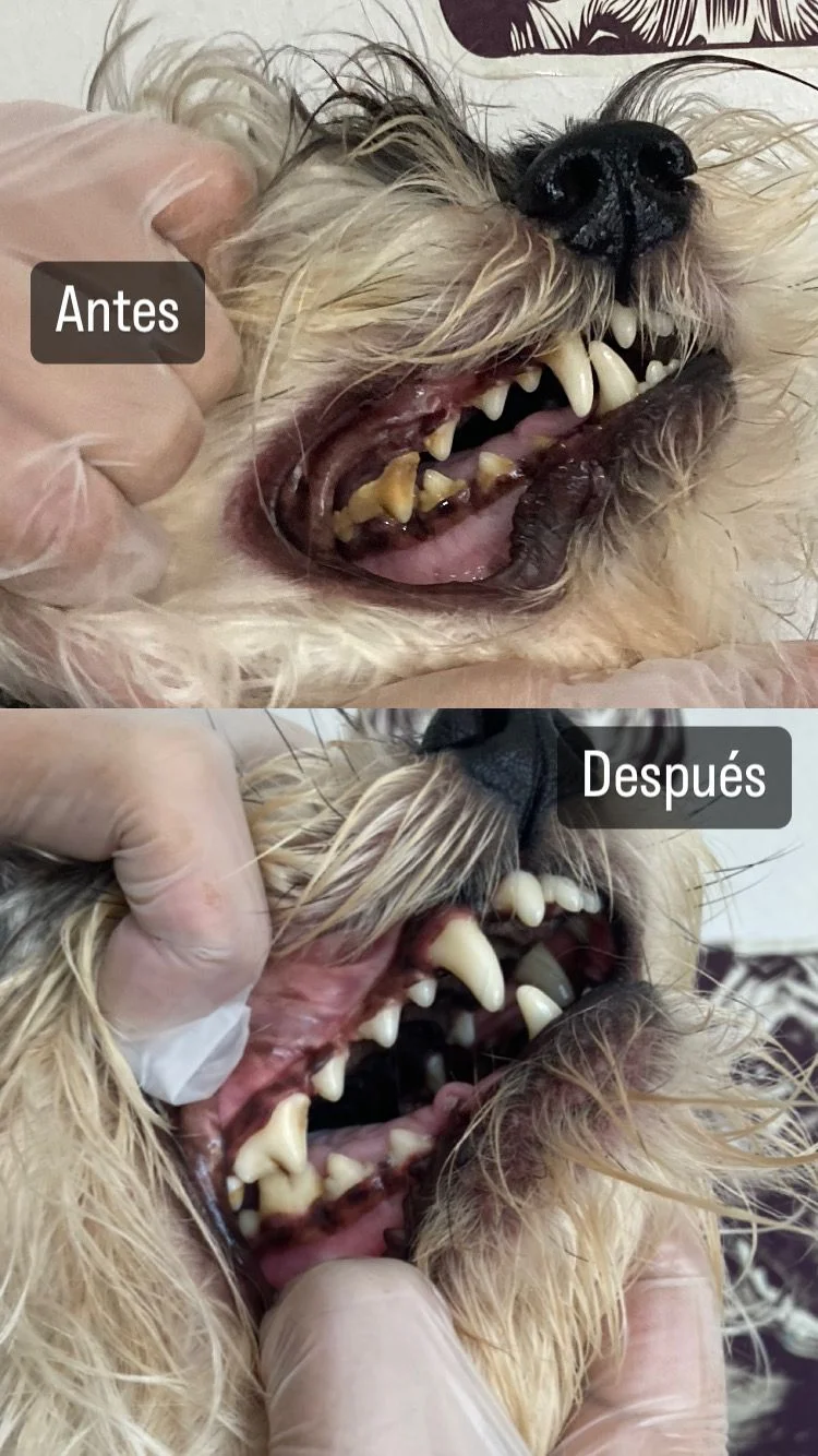 Antes y después dental 6